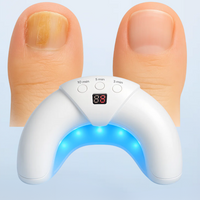 Erweiterte Nagelpilz Therapie Licht